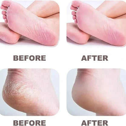 Rechargeable Electric Callus Removers