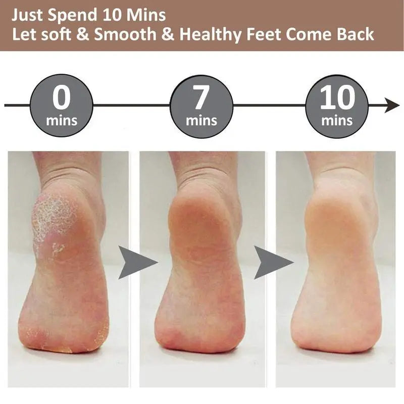 Rechargeable Electric Callus Removers