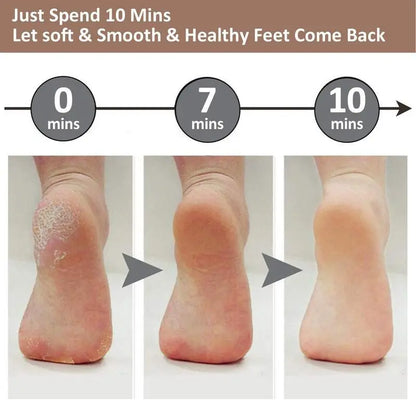 Rechargeable Electric Callus Removers