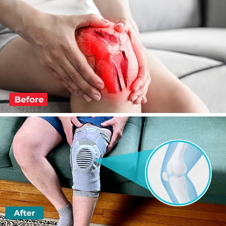 Compression Support Strap, Breathable Meniscus Knee Brace for Running Joint Protection Sold as one pair (2 pieces)