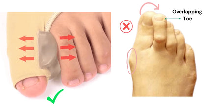 Gel Forefoot Cushion Sleeves – 1 Pair – product image 4
