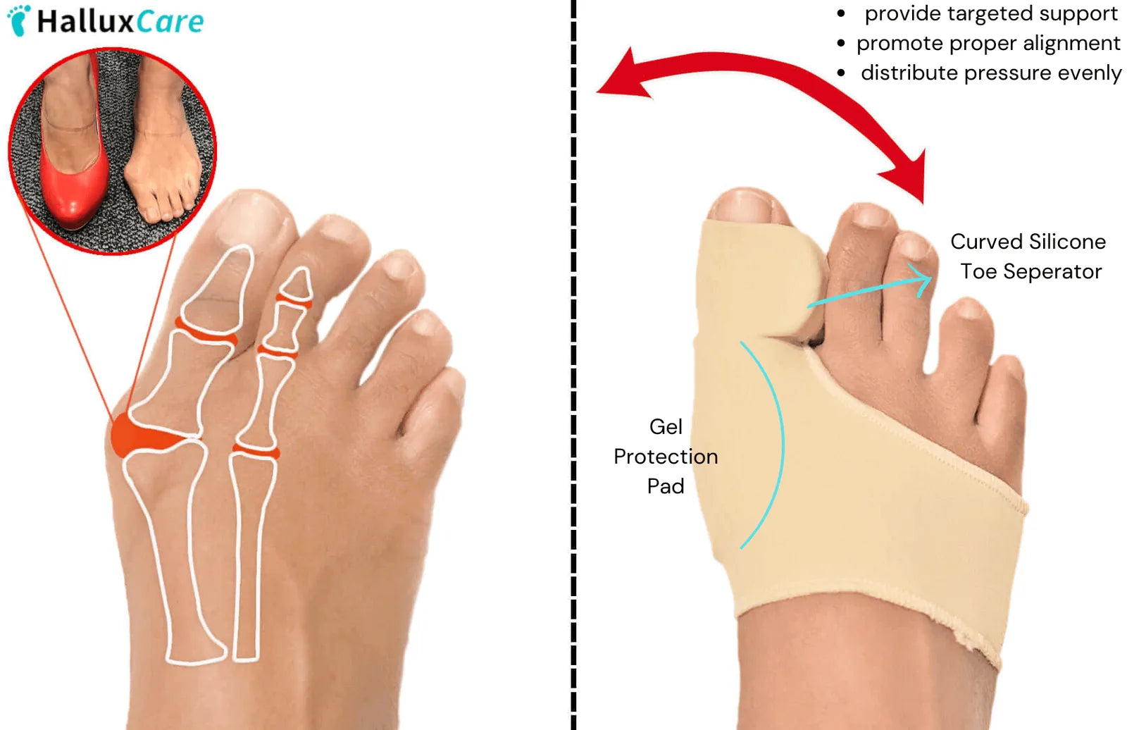 Gel Forefoot Cushion Sleeves – 1 Pair – product image 6